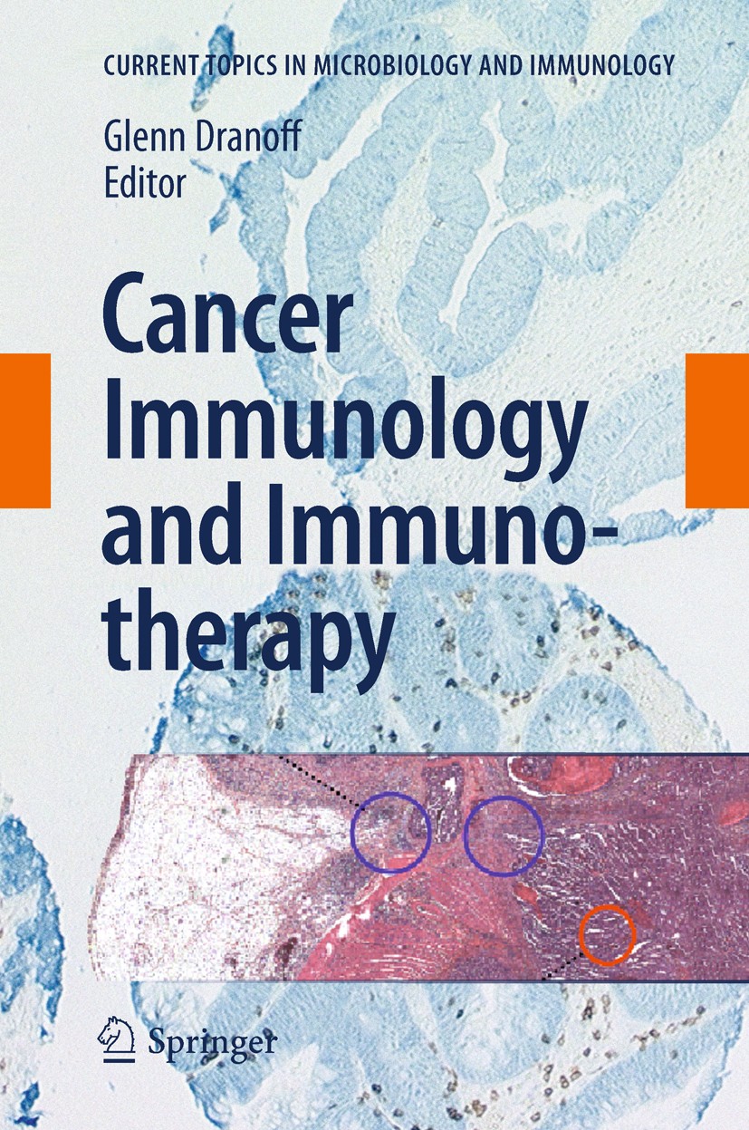 Titlebook: Cancer Immunology and Immunotherapy; Glenn Dranoff Book 2011 The Editor(s) (if applicable) and The Author(s), under exclusive license to S Titlebook: Cancer Immunology and Immunotherapy; Glenn Dranoff Book 2011 The Editor(s) (if applicable) and The Author(s), under exclusive license to S