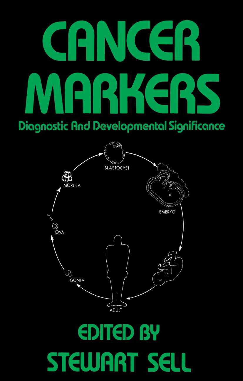 Titlebook: Cancer Markers; Diagnostic and Devel Stewart Sell Book 1980 The HUMANA Press Inc. 1980 cancer.carcinogenesis.carcinoma.cell.classification. Titlebook: Cancer Markers; Diagnostic and Devel Stewart Sell Book 1980 The HUMANA Press Inc. 1980 cancer.carcinogenesis.carcinoma.cell.classification.