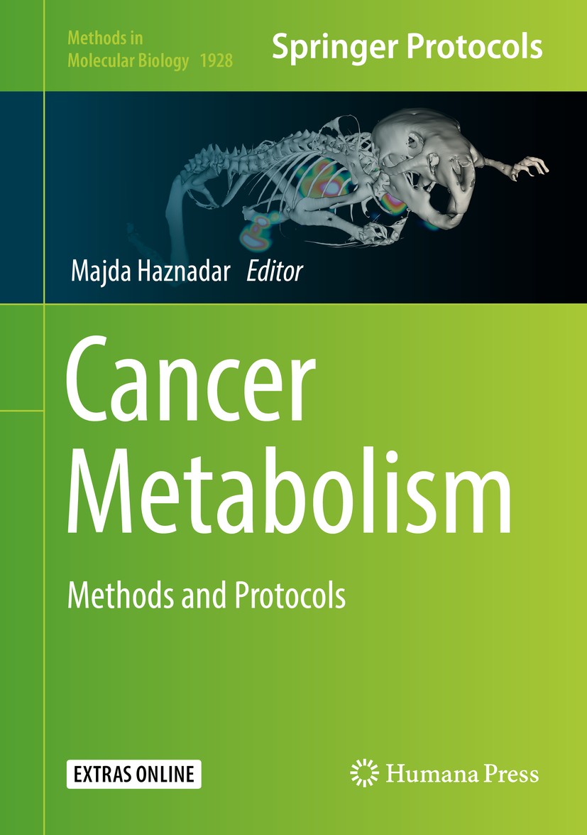 Titlebook: Cancer Metabolism; Methods and Protocol Majda Haznadar Book 2019 Springer Science+Business Media, LLC, part of Springer Nature 2019 Human B Titlebook: Cancer Metabolism; Methods and Protocol Majda Haznadar Book 2019 Springer Science+Business Media, LLC, part of Springer Nature 2019 Human B
