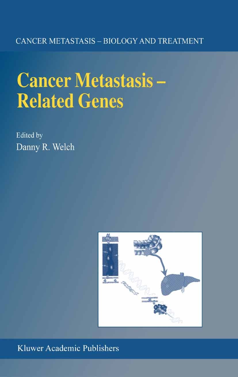 Titlebook: Cancer Metastasis — Related Genes; Danny R. Welch Book 2002 Springer Science+Business Media Dordrecht 2002 cancer.cancer research.carcinom Titlebook: Cancer Metastasis — Related Genes; Danny R. Welch Book 2002 Springer Science+Business Media Dordrecht 2002 cancer.cancer research.carcinom