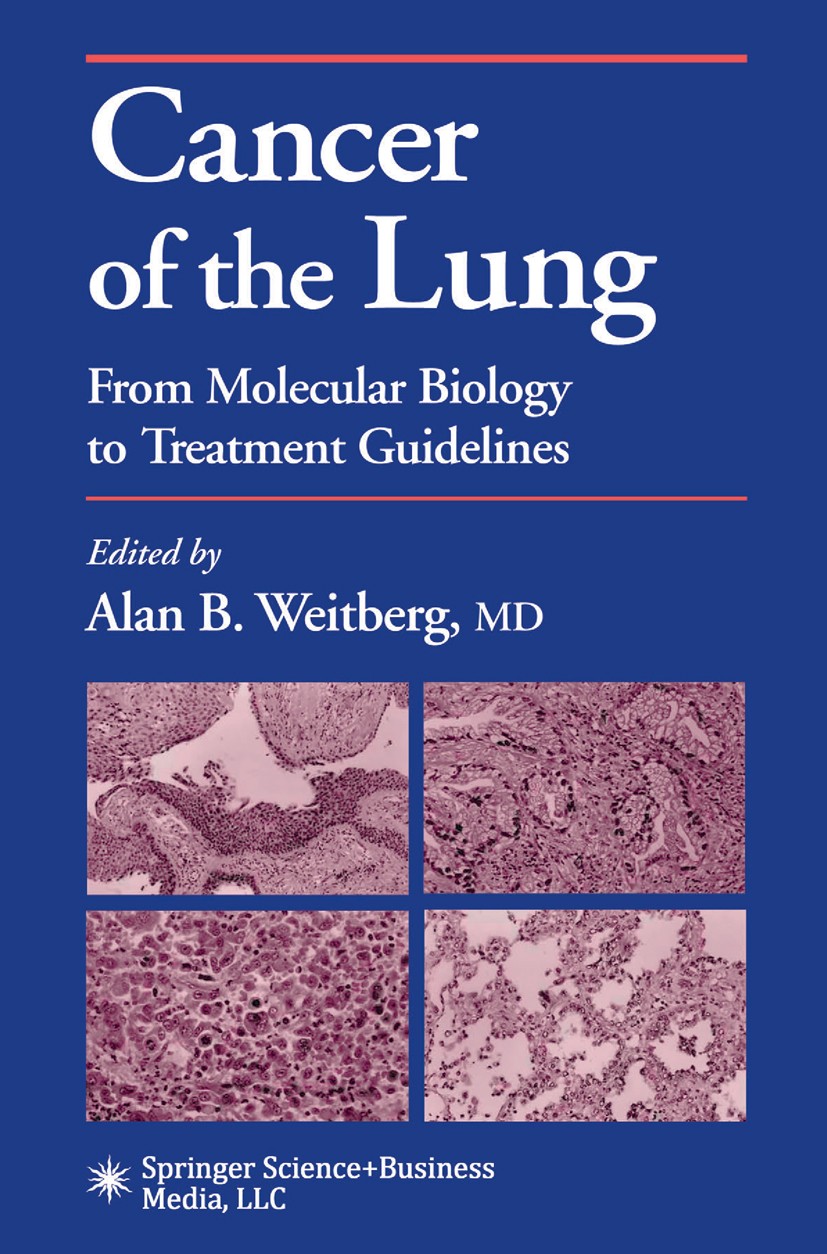 Titlebook: Cancer of the Lung; From Molecular Biolo Alan B. Weitberg (Professor and Chairman) Book 2002 Springer Science+Business Media New York 2002 Titlebook: Cancer of the Lung; From Molecular Biolo Alan B. Weitberg (Professor and Chairman) Book 2002 Springer Science+Business Media New York 2002