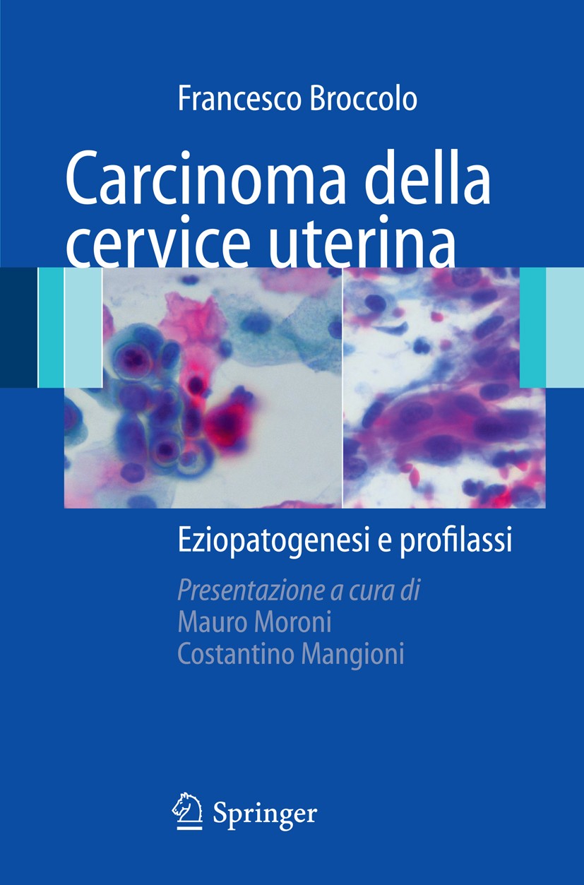 Titlebook: Carcinoma della cervice uterina; Eziopatogenesi e pro Francesco Broccolo Book 2008 Springer-Verlag Milan 2008 Immunoprofilassi.Papillomavir Titlebook: Carcinoma della cervice uterina; Eziopatogenesi e pro Francesco Broccolo Book 2008 Springer-Verlag Milan 2008 Immunoprofilassi.Papillomavir
