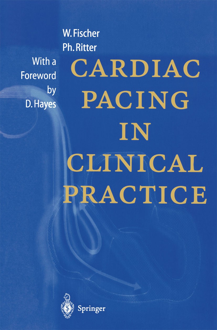 Titlebook: Cardiac Pacing in Clinical Practice; Wilhelm Fischer,Philippe Ritter Book 1998 Springer-Verlag Berlin Heidelberg 1998 anatomy.arrhythmia.c Titlebook: Cardiac Pacing in Clinical Practice; Wilhelm Fischer,Philippe Ritter Book 1998 Springer-Verlag Berlin Heidelberg 1998 anatomy.arrhythmia.c