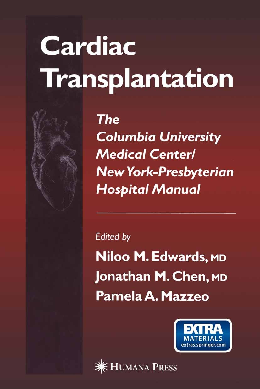 Titlebook: Cardiac Transplantation; The Columbia Univers Niloo M. Edwards,Jonathan M. Chen,Pamela A. Mazzeo Book 2004 Springer Science+Business Media Titlebook: Cardiac Transplantation; The Columbia Univers Niloo M. Edwards,Jonathan M. Chen,Pamela A. Mazzeo Book 2004 Springer Science+Business Media