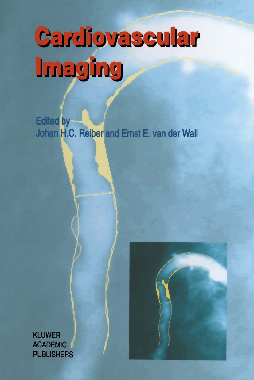Titlebook: Cardiovascular Imaging; Johan H. C. Reiber,Ernst E. Wall Book 1996 Kluwer Academic Publishers 1996 Stent.cardiovascular.computed tomograph Titlebook: Cardiovascular Imaging; Johan H. C. Reiber,Ernst E. Wall Book 1996 Kluwer Academic Publishers 1996 Stent.cardiovascular.computed tomograph