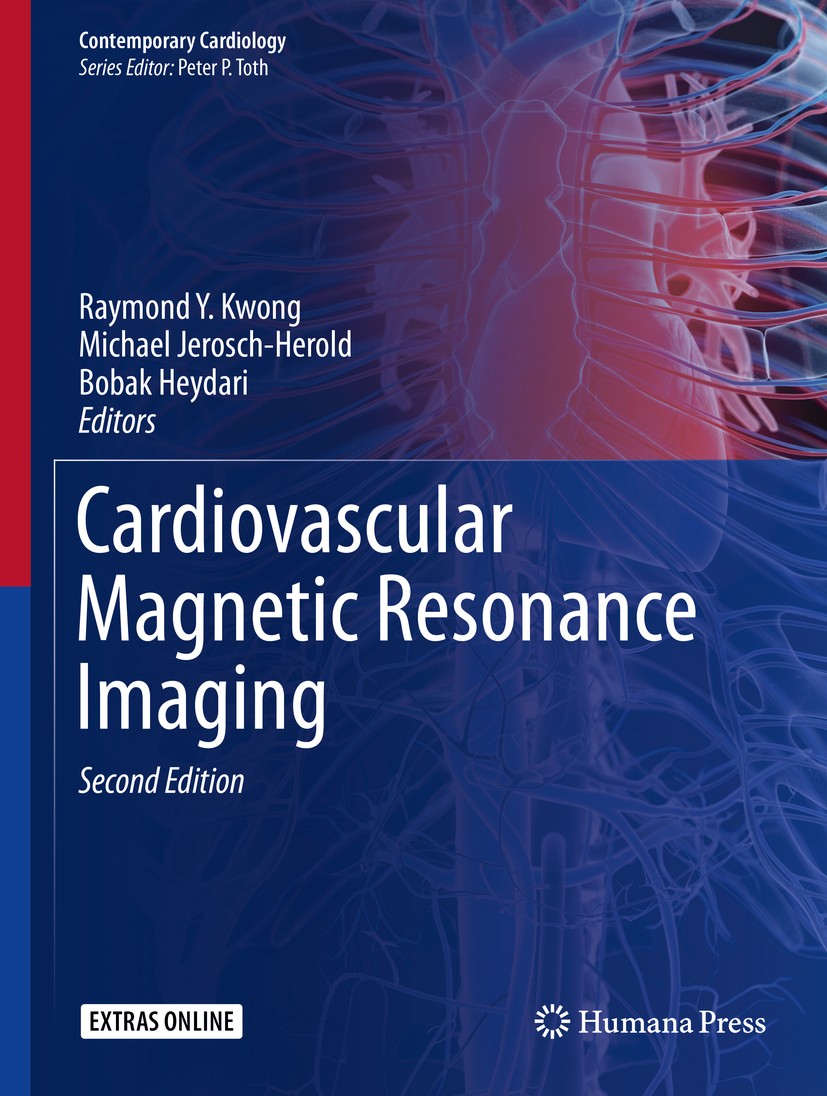 Titlebook: Cardiovascular Magnetic Resonance Imaging; Raymond Y. Kwong,Michael Jerosch-Herold,Bobak Heyd Book 2019Latest edition Springer Science+Bus Titlebook: Cardiovascular Magnetic Resonance Imaging; Raymond Y. Kwong,Michael Jerosch-Herold,Bobak Heyd Book 2019Latest edition Springer Science+Bus