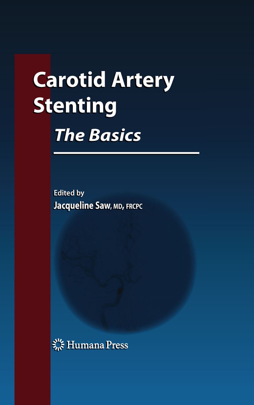 Titlebook: Carotid Artery Stenting: The Basics; Jacqueline Saw Book 2009 Humana Press 2009 Carotid Artery.Endarterectomy.Extracranial.Stenosis.Stent. Titlebook: Carotid Artery Stenting: The Basics; Jacqueline Saw Book 2009 Humana Press 2009 Carotid Artery.Endarterectomy.Extracranial.Stenosis.Stent.