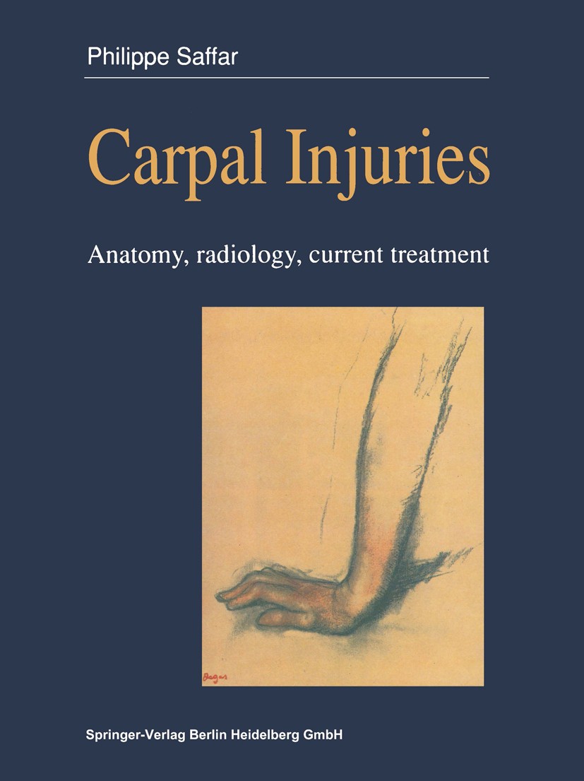 Titlebook: Carpal injuries; Anatomy, radiology, Philippe Saffar Book 1990 Springer-Verlag Berlin Heidelberg 1990 Handgelenk.Handwurzelerkrankung.Radi Titlebook: Carpal injuries; Anatomy, radiology, Philippe Saffar Book 1990 Springer-Verlag Berlin Heidelberg 1990 Handgelenk.Handwurzelerkrankung.Radi