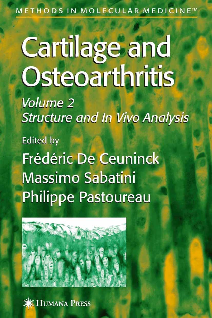Titlebook: Cartilage and Osteoarthritis; Frédéric Ceuninck,Massimo Sabatini,Philippe Pastou Book 2004 Humana Press 2004 Arthritis.bone.cartilage.comp Titlebook: Cartilage and Osteoarthritis; Frédéric Ceuninck,Massimo Sabatini,Philippe Pastou Book 2004 Humana Press 2004 Arthritis.bone.cartilage.comp