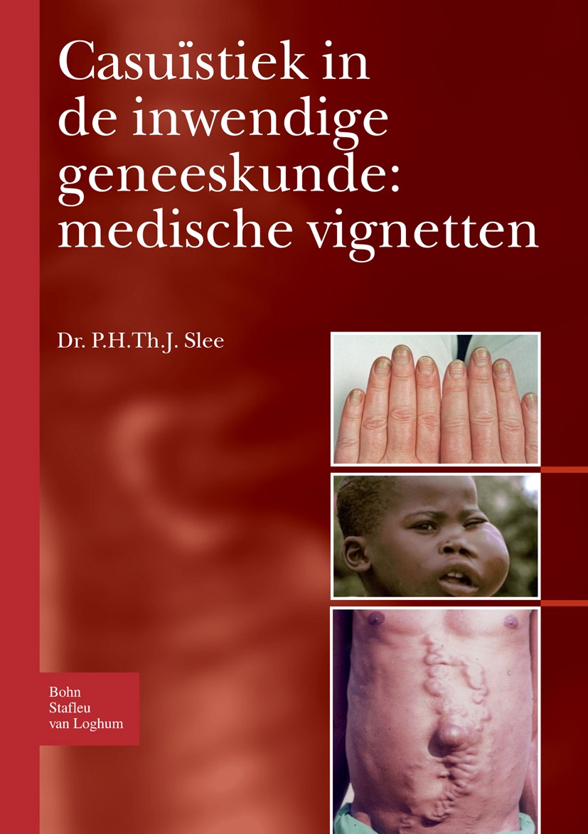 Titlebook: Casuïstiek in de inwendige geneeskunde: medische vignetten; P.H.Th.J. Slee Book 2008Latest edition Bohn Stafleu van Loghum 2008 Titlebook: Casuïstiek in de inwendige geneeskunde: medische vignetten; P.H.Th.J. Slee Book 2008Latest edition Bohn Stafleu van Loghum 2008
