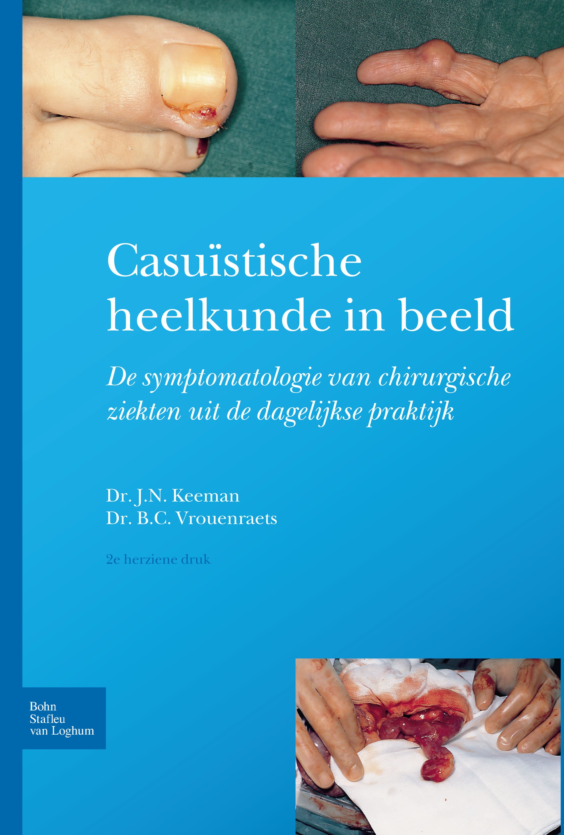 Titlebook: Casuïstische heelkunde in beeld; Symptomatologie van J. N. Keeman,B. C. Vrouenraets Book 2012Latest edition Bohn Stafleu van Loghum 2012 Titlebook: Casuïstische heelkunde in beeld; Symptomatologie van J. N. Keeman,B. C. Vrouenraets Book 2012Latest edition Bohn Stafleu van Loghum 2012