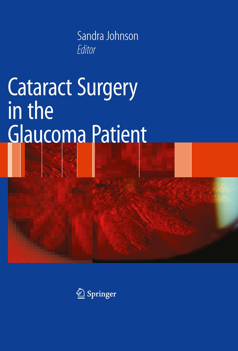 Titlebook: Cataract Surgery in the Glaucoma Patient; Sandra M. Johnson Book 20091st edition Springer-Verlag New York 2009 Cataracts.Eyecare of the el Titlebook: Cataract Surgery in the Glaucoma Patient; Sandra M. Johnson Book 20091st edition Springer-Verlag New York 2009 Cataracts.Eyecare of the el