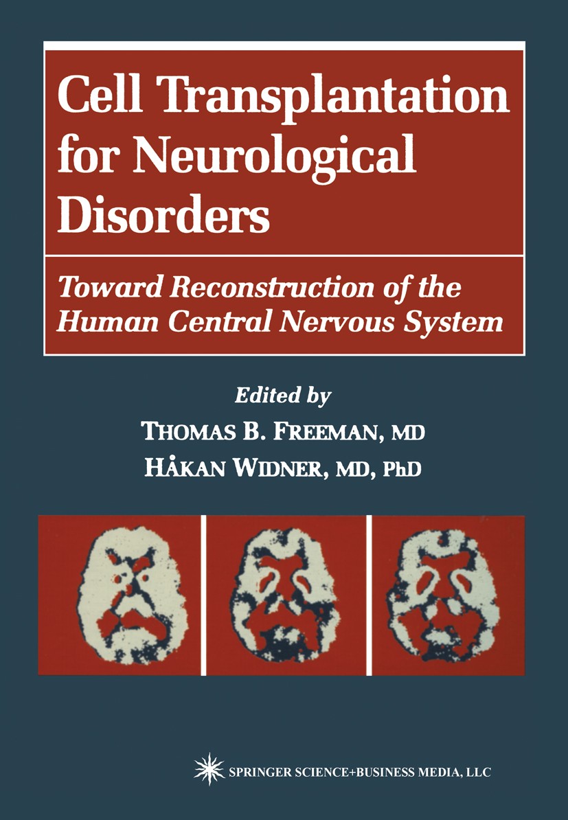 Titlebook: Cell Transplantation for Neurological Disorders; Toward Reconstructio Thomas B. Freeman,Håkan Widner Book 1998 Springer Science+Business Me Titlebook: Cell Transplantation for Neurological Disorders; Toward Reconstructio Thomas B. Freeman,Håkan Widner Book 1998 Springer Science+Business Me