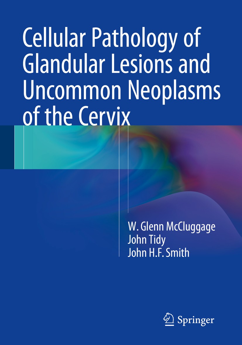 Titlebook: Cellular Pathology of Glandular Lesions and Uncommon Neoplasms of the Cervix; W. Glenn McCluggage,John Tidy,John H.F. Smith Book 2014 Spri Titlebook: Cellular Pathology of Glandular Lesions and Uncommon Neoplasms of the Cervix; W. Glenn McCluggage,John Tidy,John H.F. Smith Book 2014 Spri