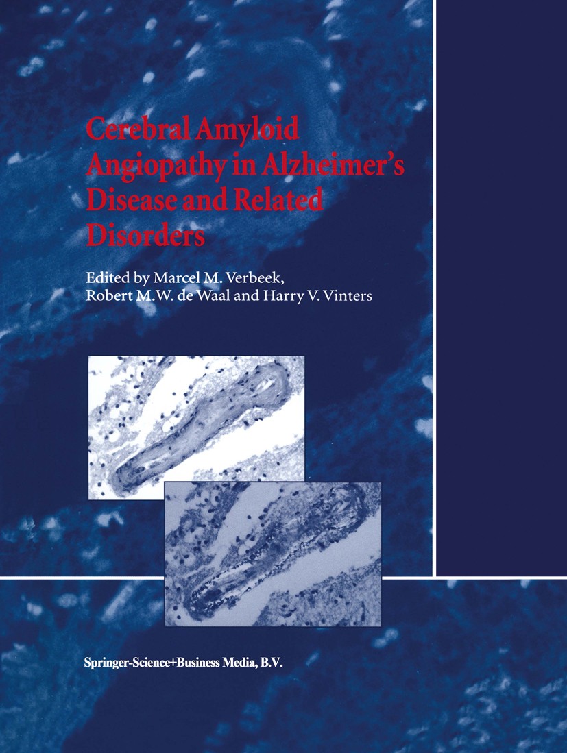 Titlebook: Cerebral Amyloid Angiopathy in Alzheimer’s Disease and Related Disorders; Marcel M. Verbeek,Robert M. W. Waal,Harry V. Vinte Book 2000 Spr Titlebook: Cerebral Amyloid Angiopathy in Alzheimer’s Disease and Related Disorders; Marcel M. Verbeek,Robert M. W. Waal,Harry V. Vinte Book 2000 Spr