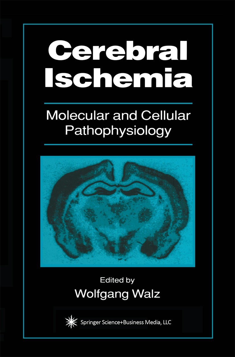Titlebook: Cerebral Ischemia; Molecular and Cellul Wolfgang Walz Book 1999 Springer Science+Business Media New York 1999 brain.brain injury.cell.cereb Titlebook: Cerebral Ischemia; Molecular and Cellul Wolfgang Walz Book 1999 Springer Science+Business Media New York 1999 brain.brain injury.cell.cereb