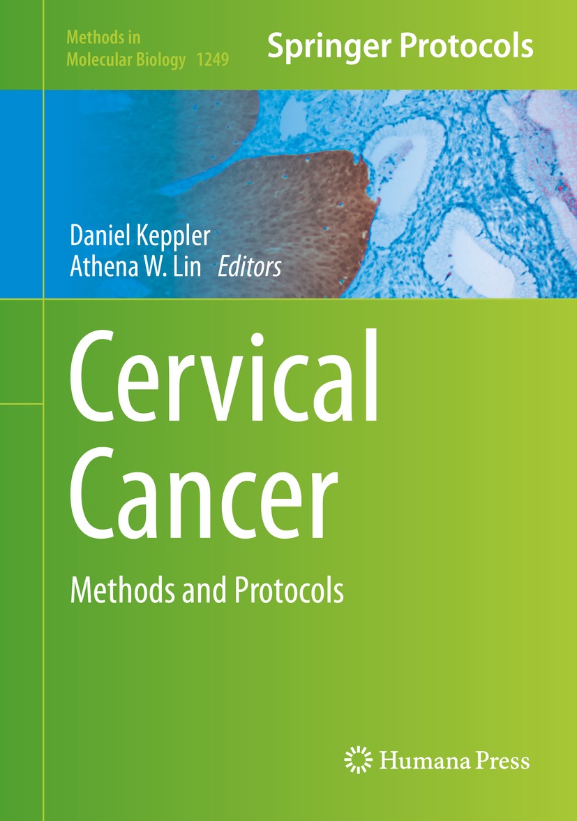 Titlebook: Cervical Cancer; Methods and Protocol Daniel Keppler,Athena W. Lin Book 2015 Springer Science+Business Media New York 2015 Cervix.CxCA.Drug Titlebook: Cervical Cancer; Methods and Protocol Daniel Keppler,Athena W. Lin Book 2015 Springer Science+Business Media New York 2015 Cervix.CxCA.Drug