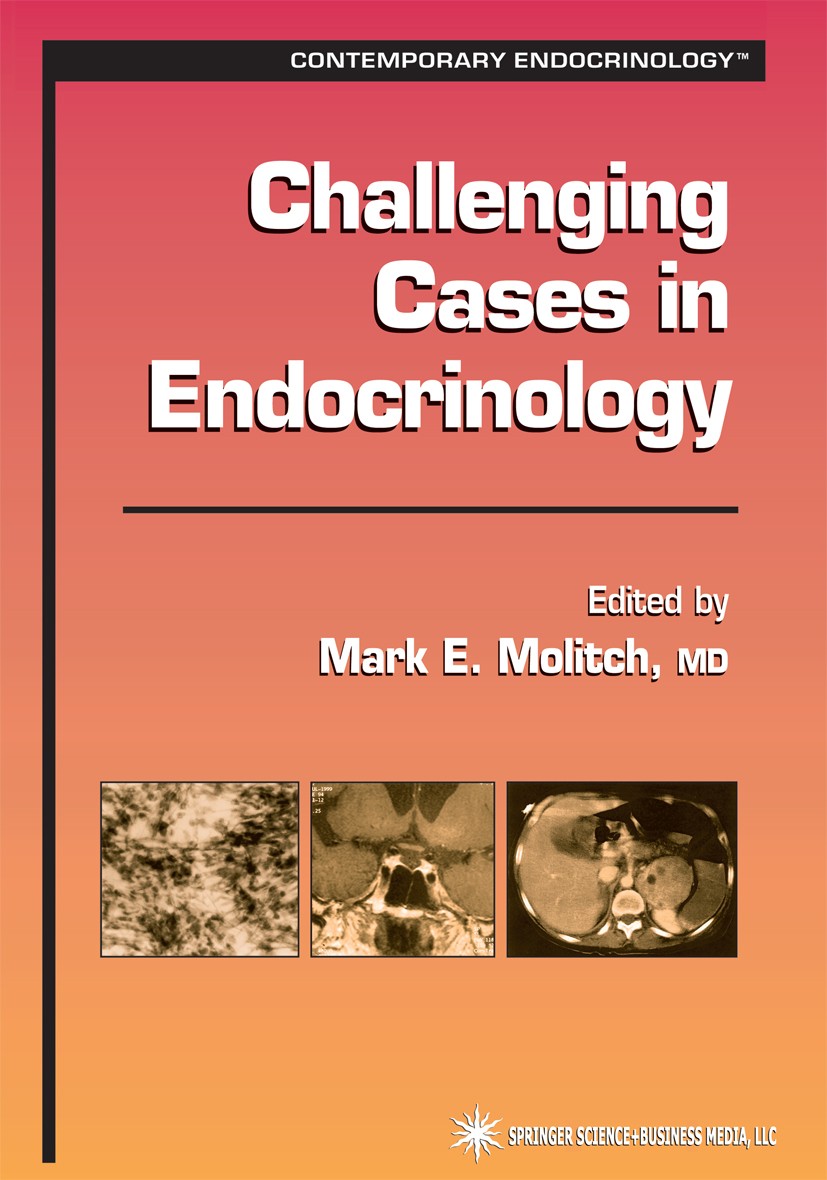Titlebook: Challenging Cases in Endocrinology; Mark E. Molitch Book 2002 Springer Science+Business Media New York 2002 Diabetes.Diabetes mellitus.gro Titlebook: Challenging Cases in Endocrinology; Mark E. Molitch Book 2002 Springer Science+Business Media New York 2002 Diabetes.Diabetes mellitus.gro