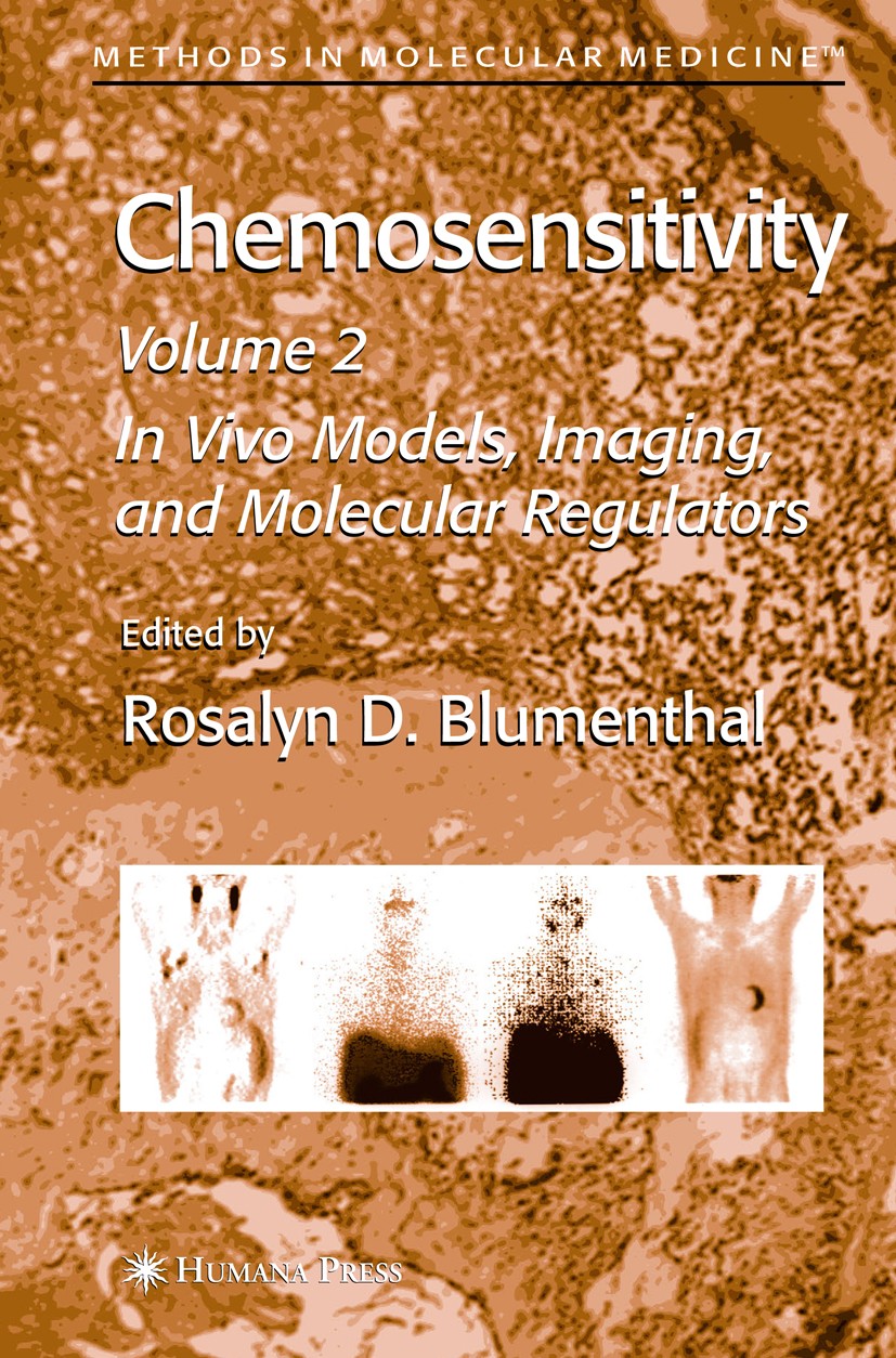 Titlebook: Chemosensitivity; Volume II: In Vivo M Rosalyn D. Blumenthal Book 2005 Humana Press 2005 DNA.apoptosis.cell.cell death.chemoresistance.geno Titlebook: Chemosensitivity; Volume II: In Vivo M Rosalyn D. Blumenthal Book 2005 Humana Press 2005 DNA.apoptosis.cell.cell death.chemoresistance.geno