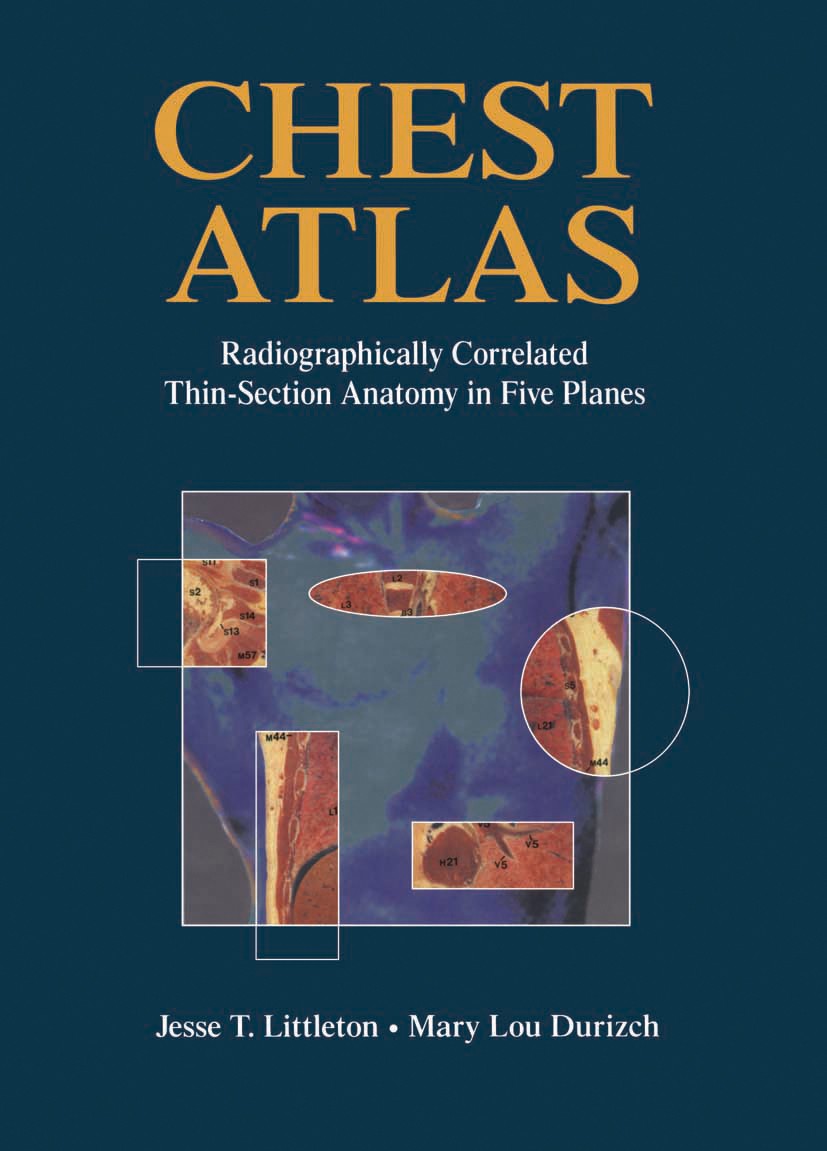 Titlebook: Chest Atlas; Radiographically Cor M. L. Durizch,J. T. Littleton Book 1994 Springer-Verlag New York, Inc. 1994 Anatomie.Brust.Thoraxorgan.co Titlebook: Chest Atlas; Radiographically Cor M. L. Durizch,J. T. Littleton Book 1994 Springer-Verlag New York, Inc. 1994 Anatomie.Brust.Thoraxorgan.co