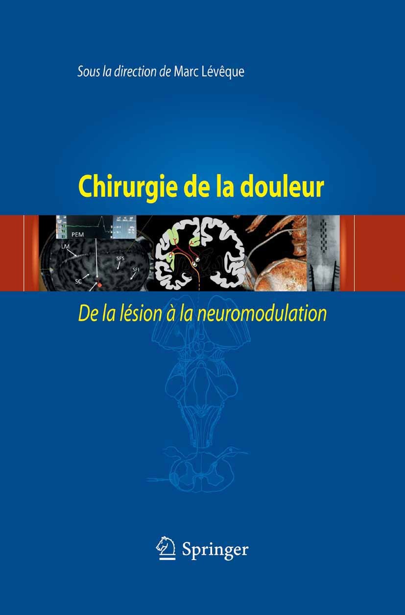 Titlebook: Chirurgie de la douleur; De la lésion à la ne Marc Lévêque Book 2014Latest edition Springer-Verlag France 2014 Douleur chronique.Neurochiru Titlebook: Chirurgie de la douleur; De la lésion à la ne Marc Lévêque Book 2014Latest edition Springer-Verlag France 2014 Douleur chronique.Neurochiru