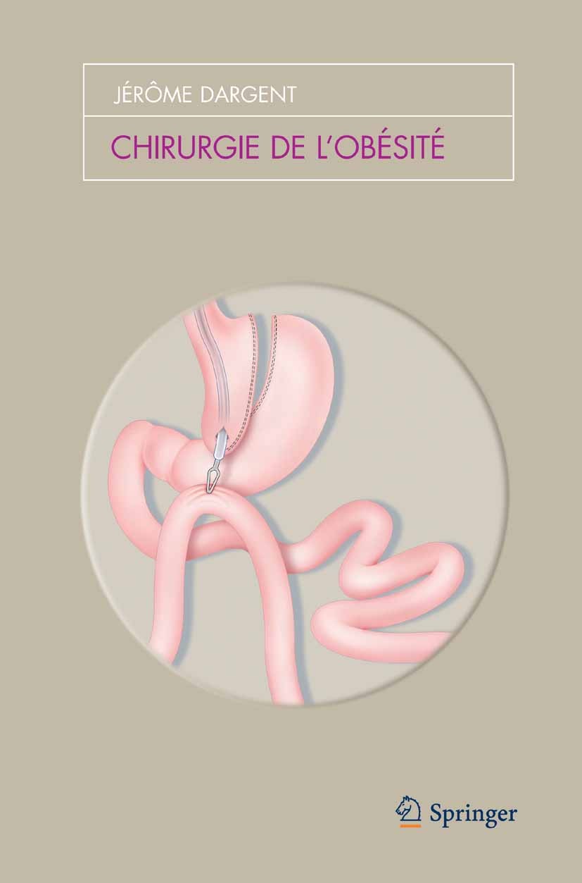 Titlebook: Chirurgie de l‘obésité; Jérôme Dargent Book 2009Latest edition Springer-Verlag Paris 2009 Absorption.Surgery.anneau gastrique.bypass gastr Titlebook: Chirurgie de l‘obésité; Jérôme Dargent Book 2009Latest edition Springer-Verlag Paris 2009 Absorption.Surgery.anneau gastrique.bypass gastr