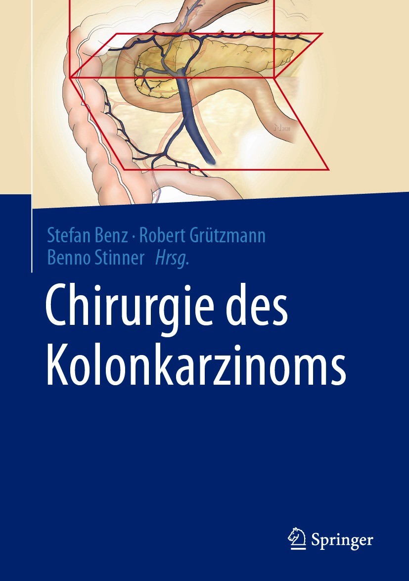 Titlebook: Chirurgie des Kolonkarzinoms; Stefan Benz,Robert Grützmann,Benno Stinner Book 2021 Springer-Verlag GmbH Deutschland, ein Teil von Springer Titlebook: Chirurgie des Kolonkarzinoms; Stefan Benz,Robert Grützmann,Benno Stinner Book 2021 Springer-Verlag GmbH Deutschland, ein Teil von Springer