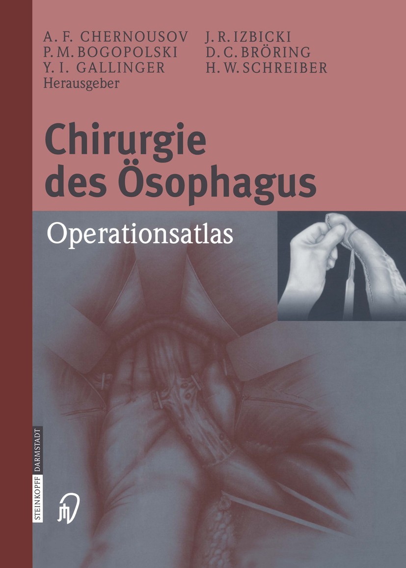 Titlebook: Chirurgie des Ösophagus; Operationsatlas A. F. Chernousov,P. M. Bogopolski,H. W. Schreiber Book 2003 Springer-Verlag Berlin Heidelberg 200 Titlebook: Chirurgie des Ösophagus; Operationsatlas A. F. Chernousov,P. M. Bogopolski,H. W. Schreiber Book 2003 Springer-Verlag Berlin Heidelberg 200