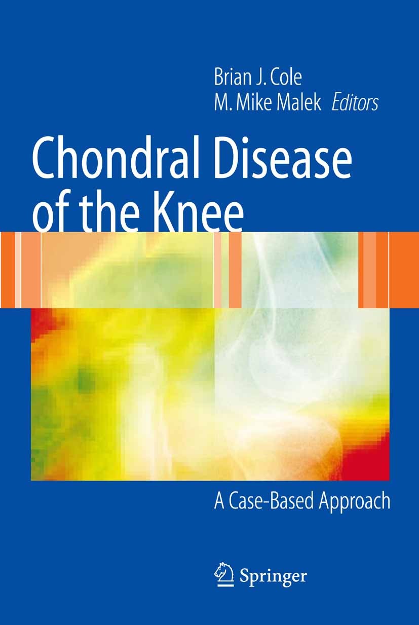 Titlebook: Chondral Disease of the Knee; A Case-Based Approac Brian J. Cole,M. Mike Malek Book 2006 Springer-Verlag New York 2006 Lesions.Osteochondra Titlebook: Chondral Disease of the Knee; A Case-Based Approac Brian J. Cole,M. Mike Malek Book 2006 Springer-Verlag New York 2006 Lesions.Osteochondra
