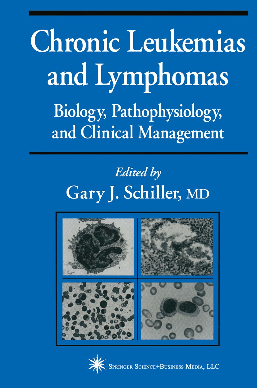 Titlebook: Chronic Leukemias and Lymphomas; Biology, Pathophysio Gary J. Schiller Book 2003 Springer Science+Business Media New York 2003 Staging.biol Titlebook: Chronic Leukemias and Lymphomas; Biology, Pathophysio Gary J. Schiller Book 2003 Springer Science+Business Media New York 2003 Staging.biol