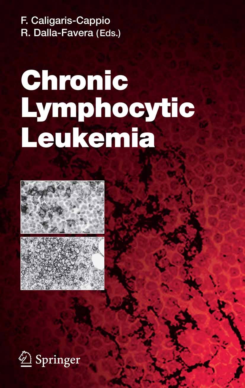 Titlebook: Chronic Lymphocytic Leukemia; Book 2005 The Editor(s) (if applicable) and The Author(s), under exclusive license to Springer-Verlag GmbH, Titlebook: Chronic Lymphocytic Leukemia; Book 2005 The Editor(s) (if applicable) and The Author(s), under exclusive license to Springer-Verlag GmbH,