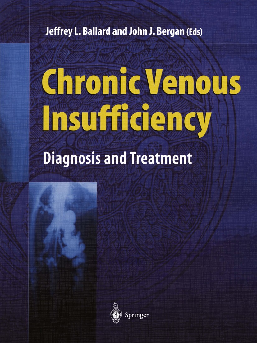 Titlebook: Chronic Venous Insufficiency; Diagnosis and Treatm Jeffrey L. Ballard,John J. Bergan Book 2000 Springer-Verlag London 2000 Stent.anatomy.em Titlebook: Chronic Venous Insufficiency; Diagnosis and Treatm Jeffrey L. Ballard,John J. Bergan Book 2000 Springer-Verlag London 2000 Stent.anatomy.em