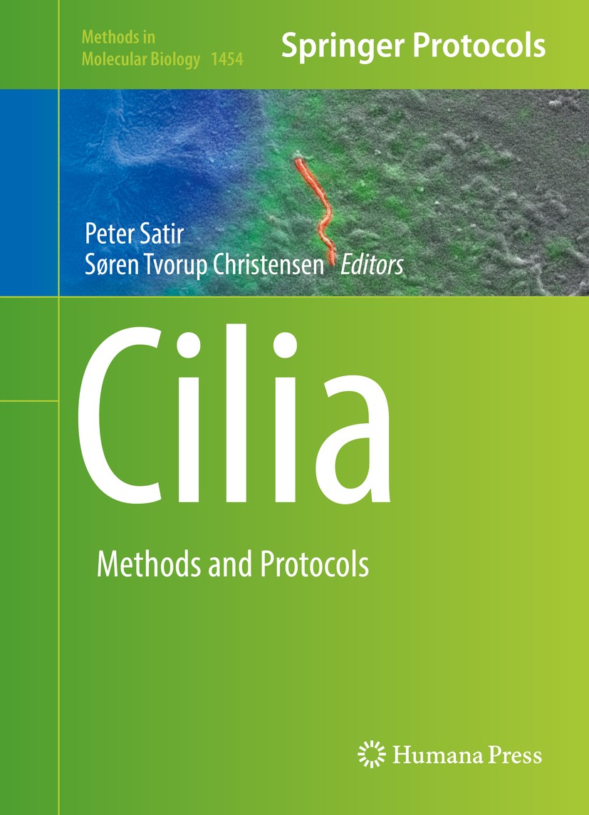 Titlebook: Cilia; Methods and Protocol Peter Satir,Søren Tvorup Christensen Book 2016 Springer Science+Business Media New York 2016 intraflagellar tra Titlebook: Cilia; Methods and Protocol Peter Satir,Søren Tvorup Christensen Book 2016 Springer Science+Business Media New York 2016 intraflagellar tra