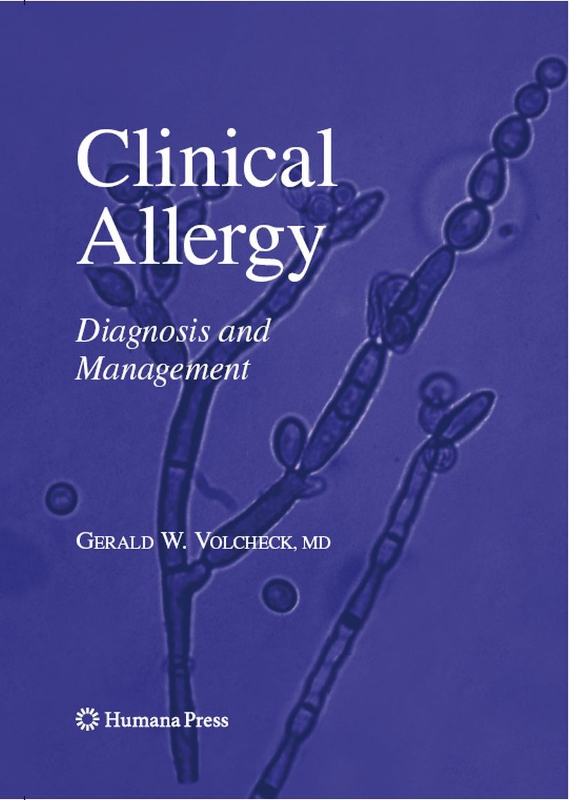 Titlebook: Clinical Allergy; Diagnosis and Manage Gerald W. Volcheck Book 2009 The Editor(s) (if applicable) and The Author(s), under exclusive licens Titlebook: Clinical Allergy; Diagnosis and Manage Gerald W. Volcheck Book 2009 The Editor(s) (if applicable) and The Author(s), under exclusive licens