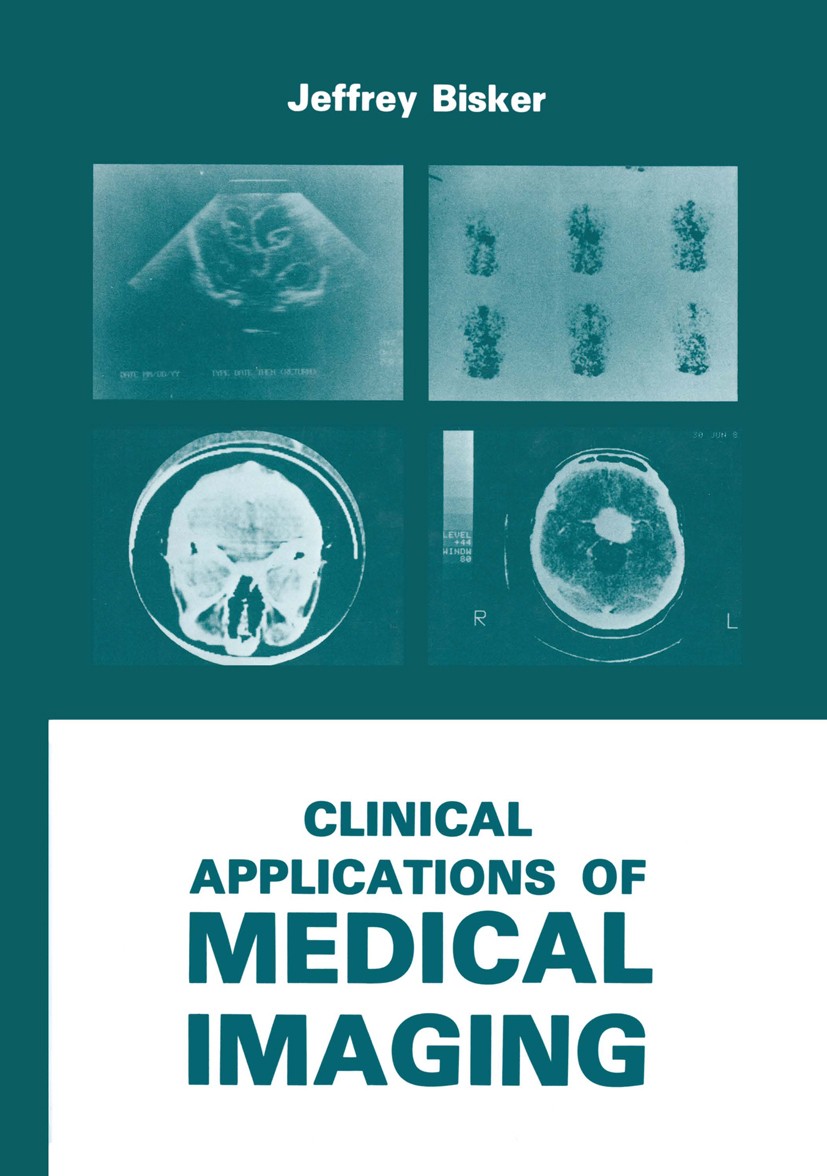 Titlebook: Clinical Applications of Medical Imaging; Jeffrey Bisker Book 1986 Plenum Press, New York 1986 classification.diagnosis.diagnostic radiolo Titlebook: Clinical Applications of Medical Imaging; Jeffrey Bisker Book 1986 Plenum Press, New York 1986 classification.diagnosis.diagnostic radiolo