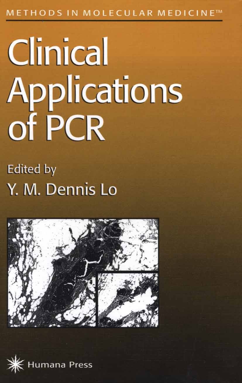 Titlebook: Clinical Applications of PCR; Y. M. Dennis Lo Book 1998 Humana Press 1998 Titlebook: Clinical Applications of PCR; Y. M. Dennis Lo Book 1998 Humana Press 1998