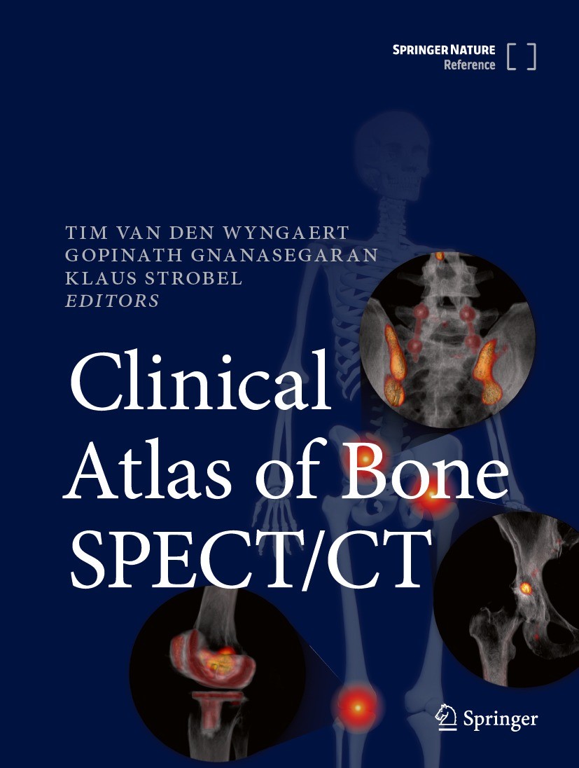 Titlebook: Clinical Atlas of Bone SPECT/CT; Tim Van den Wyngaert,Gopinath Gnanasegaran,Klaus S Reference work 2023 Springer Nature Switzerland AG 202 Titlebook: Clinical Atlas of Bone SPECT/CT; Tim Van den Wyngaert,Gopinath Gnanasegaran,Klaus S Reference work 2023 Springer Nature Switzerland AG 202