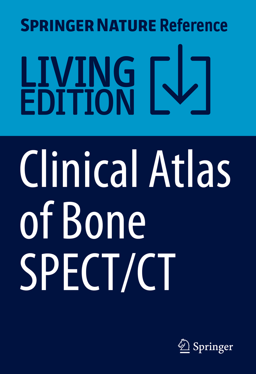 Titlebook: Clinical Atlas of Bone SPECT/CT; Tim Van den Wyngaert,Gopinath Gnanasegaran,Klaus S Living reference work 20200th edition Bone scintigrap Titlebook: Clinical Atlas of Bone SPECT/CT; Tim Van den Wyngaert,Gopinath Gnanasegaran,Klaus S Living reference work 20200th edition Bone scintigrap