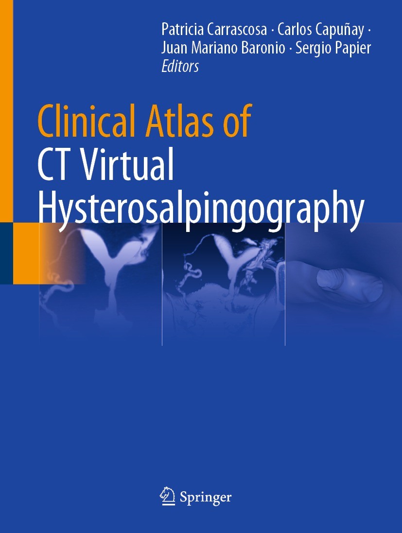 Titlebook: Clinical Atlas of CT Virtual Hysterosalpingography; Patricia Carrascosa,Carlos Capuñay,Sergio Papier Book 2021 Springer Nature Switzerland Titlebook: Clinical Atlas of CT Virtual Hysterosalpingography; Patricia Carrascosa,Carlos Capuñay,Sergio Papier Book 2021 Springer Nature Switzerland