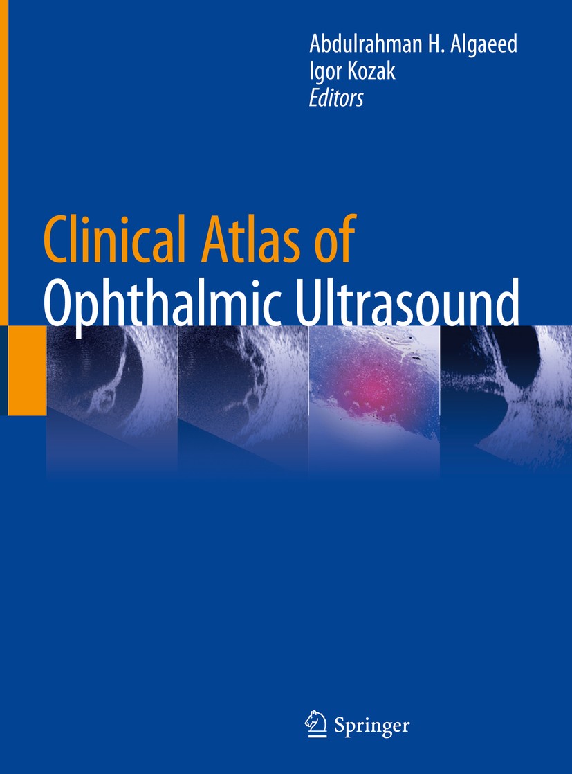 Titlebook: Clinical Atlas of Ophthalmic Ultrasound;  Abdulrahman H. Algaeed,Igor Kozak Book 2019 Springer Nature Switzerland AG 2019 ophthalmic ultras