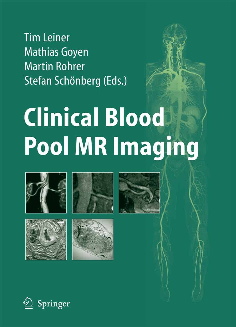 Titlebook: Clinical Blood Pool MR Imaging; Tim Leiner,Mathias Goyen,Stefan Schönberg Book 20081st edition Springer-Verlag Berlin Heidelberg 2008 MR A Titlebook: Clinical Blood Pool MR Imaging; Tim Leiner,Mathias Goyen,Stefan Schönberg Book 20081st edition Springer-Verlag Berlin Heidelberg 2008 MR A
