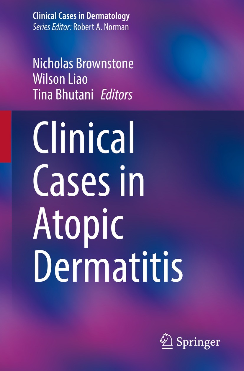 Titlebook: Clinical Cases in Atopic Dermatitis; Nicholas Brownstone,Wilson Liao,Tina Bhutani Book 2024 The Editor(s) (if applicable) and The Author(s Titlebook: Clinical Cases in Atopic Dermatitis; Nicholas Brownstone,Wilson Liao,Tina Bhutani Book 2024 The Editor(s) (if applicable) and The Author(s