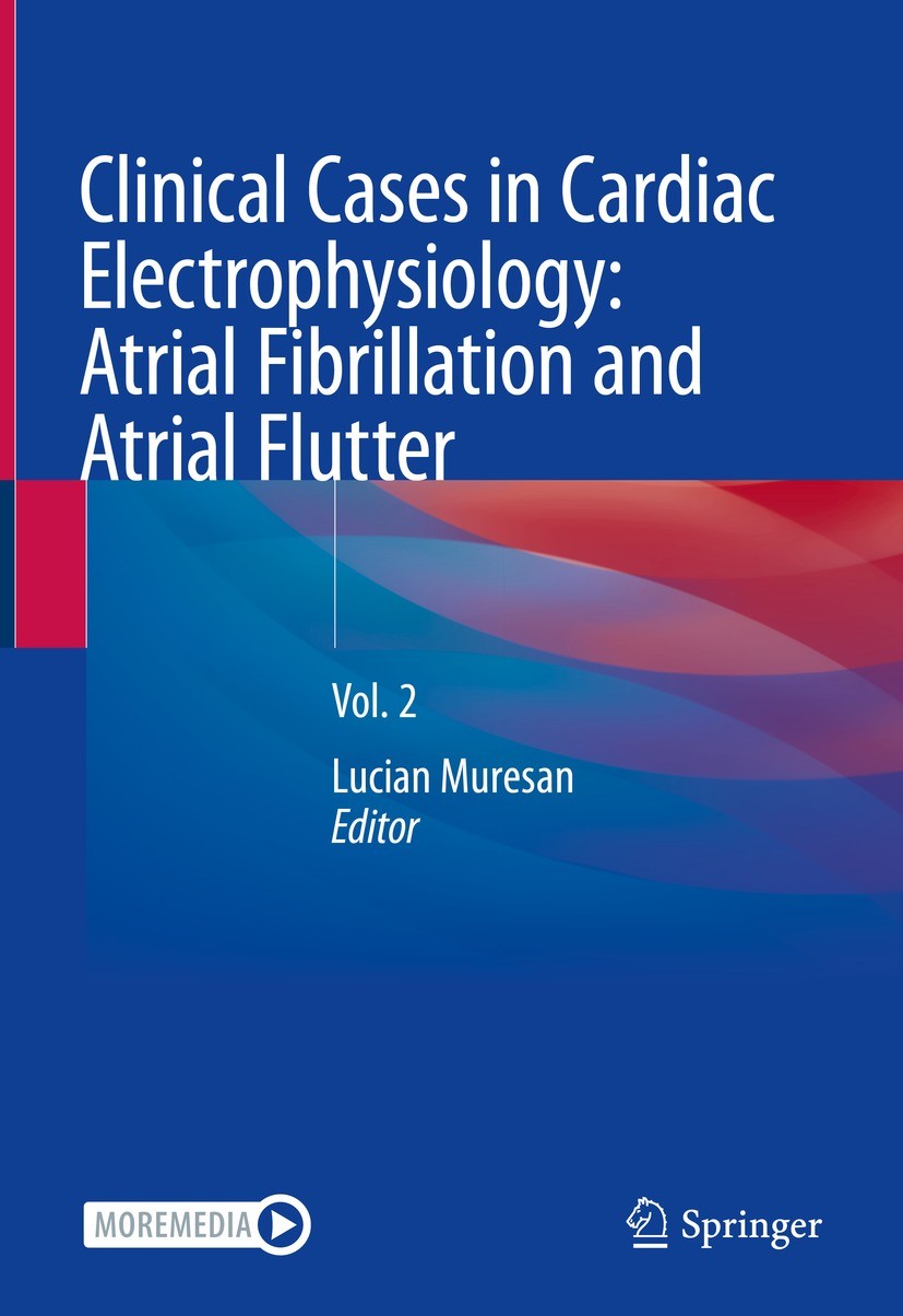 Titlebook: Clinical Cases in Cardiac Electrophysiology: Atrial Fibrillation and Atrial Flutter; Vol. 2 Lucian Muresan Textbook 2023 The Editor(s) (if Titlebook: Clinical Cases in Cardiac Electrophysiology: Atrial Fibrillation and Atrial Flutter; Vol. 2 Lucian Muresan Textbook 2023 The Editor(s) (if