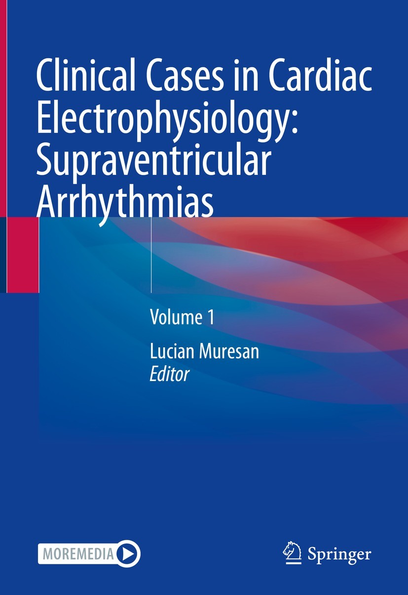 Titlebook: Clinical Cases in Cardiac Electrophysiology: Supraventricular Arrhythmias; Volume 1 Lucian Muresan Textbook 2022 The Editor(s) (if applica Titlebook: Clinical Cases in Cardiac Electrophysiology: Supraventricular Arrhythmias; Volume 1 Lucian Muresan Textbook 2022 The Editor(s) (if applica