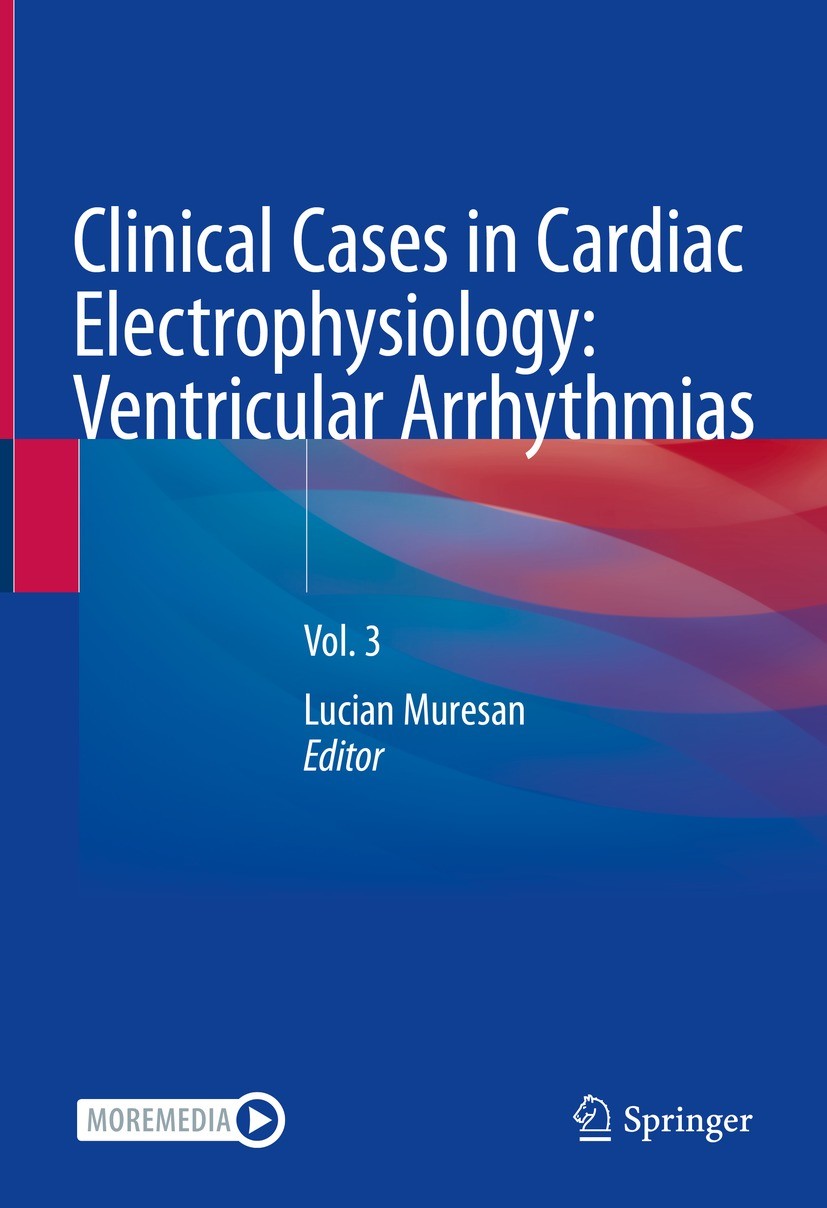 Titlebook: Clinical Cases in Cardiac Electrophysiology: Ventricular Arrhythmias; Vol. 3 Lucian Muresan Textbook 2023 The Editor(s) (if applicable) and Titlebook: Clinical Cases in Cardiac Electrophysiology: Ventricular Arrhythmias; Vol. 3 Lucian Muresan Textbook 2023 The Editor(s) (if applicable) and