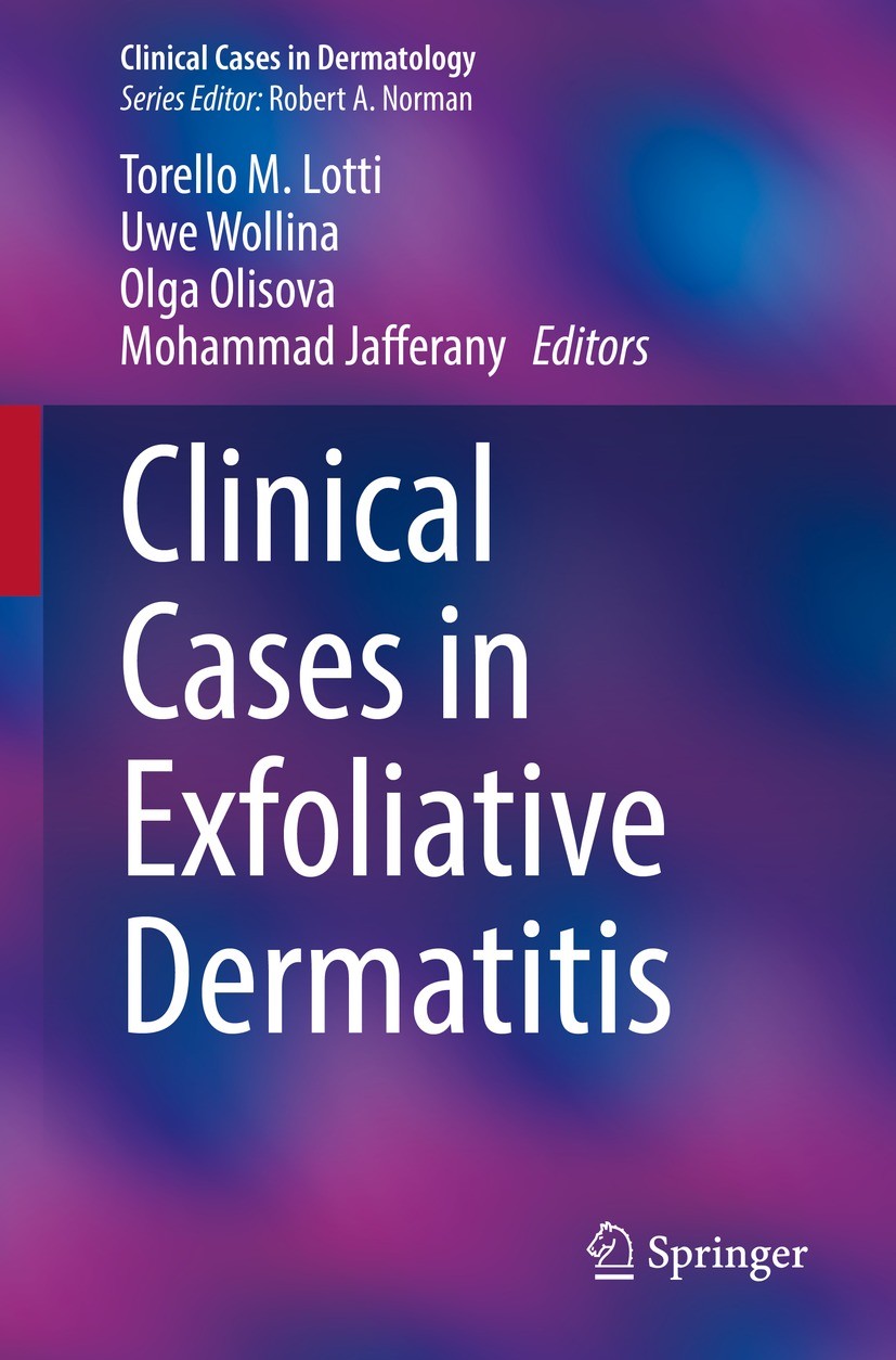 Titlebook: Clinical Cases in Exfoliative Dermatitis; Torello M. Lotti,Uwe Wollina,Mohammad Jafferany Book 2022 The Editor(s) (if applicable) and The Titlebook: Clinical Cases in Exfoliative Dermatitis; Torello M. Lotti,Uwe Wollina,Mohammad Jafferany Book 2022 The Editor(s) (if applicable) and The