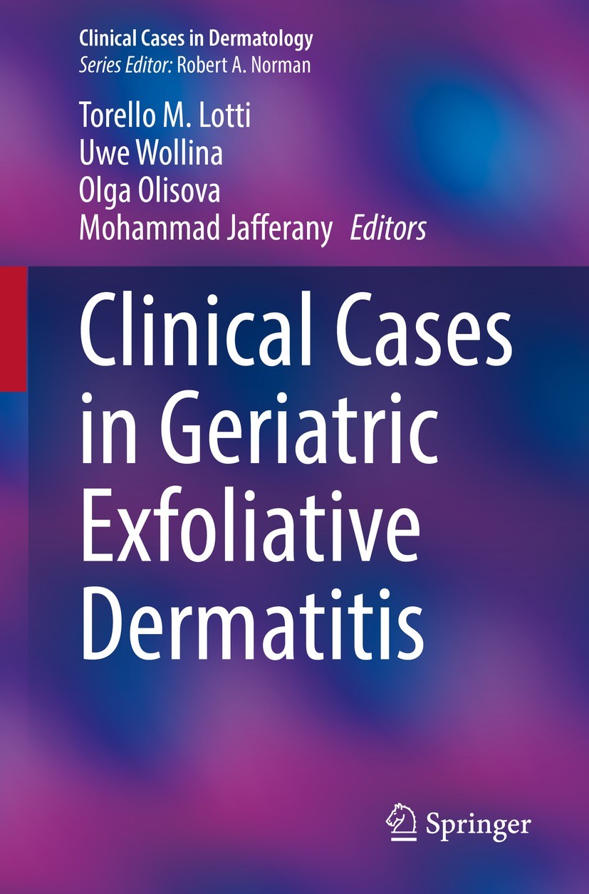 Titlebook: Clinical Cases in Geriatric Exfoliative Dermatitis; Torello M. Lotti,Uwe Wollina,Mohammad Jafferany Book 2022 The Editor(s) (if applicable Titlebook: Clinical Cases in Geriatric Exfoliative Dermatitis; Torello M. Lotti,Uwe Wollina,Mohammad Jafferany Book 2022 The Editor(s) (if applicable