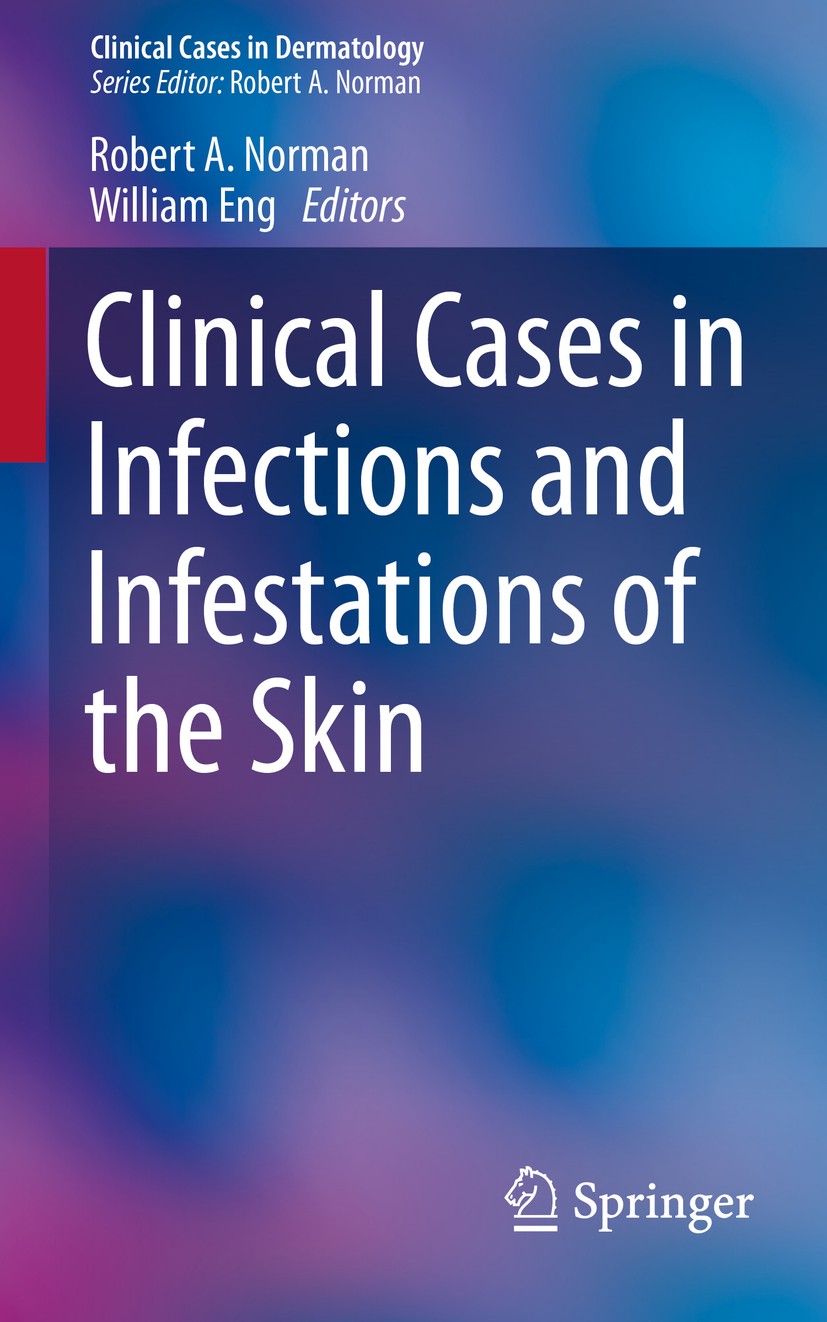 Titlebook: Clinical Cases in Infections and Infestations of the Skin; Robert A. Norman,William Eng Book 2015 Springer International Publishing Switze Titlebook: Clinical Cases in Infections and Infestations of the Skin; Robert A. Norman,William Eng Book 2015 Springer International Publishing Switze