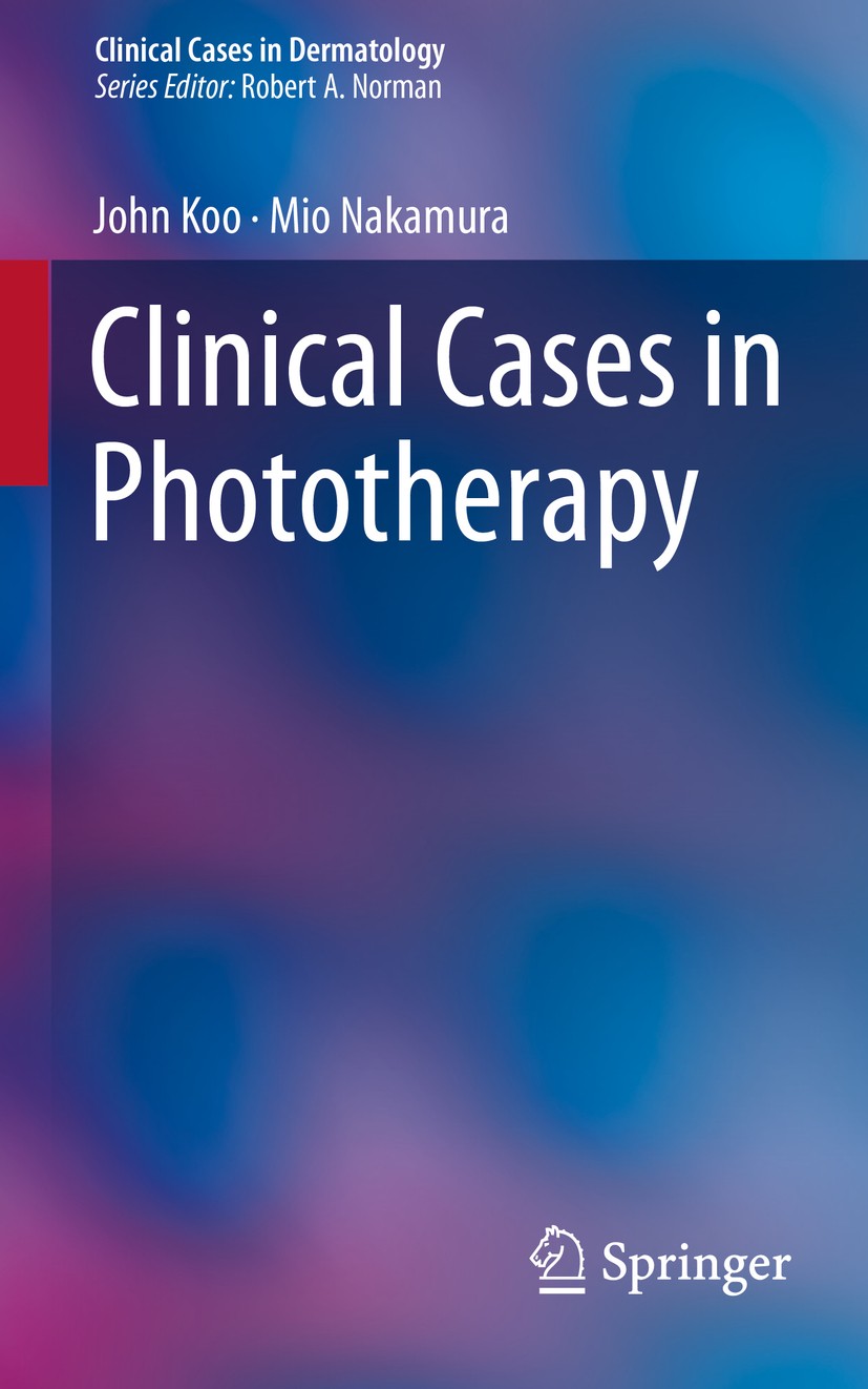 Titlebook: Clinical Cases in Phototherapy; John Koo,Mio Nakamura Book 2017 Springer International Publishing AG 2017 Phototherapy.Ultraviolet B.PUVA. Titlebook: Clinical Cases in Phototherapy; John Koo,Mio Nakamura Book 2017 Springer International Publishing AG 2017 Phototherapy.Ultraviolet B.PUVA.