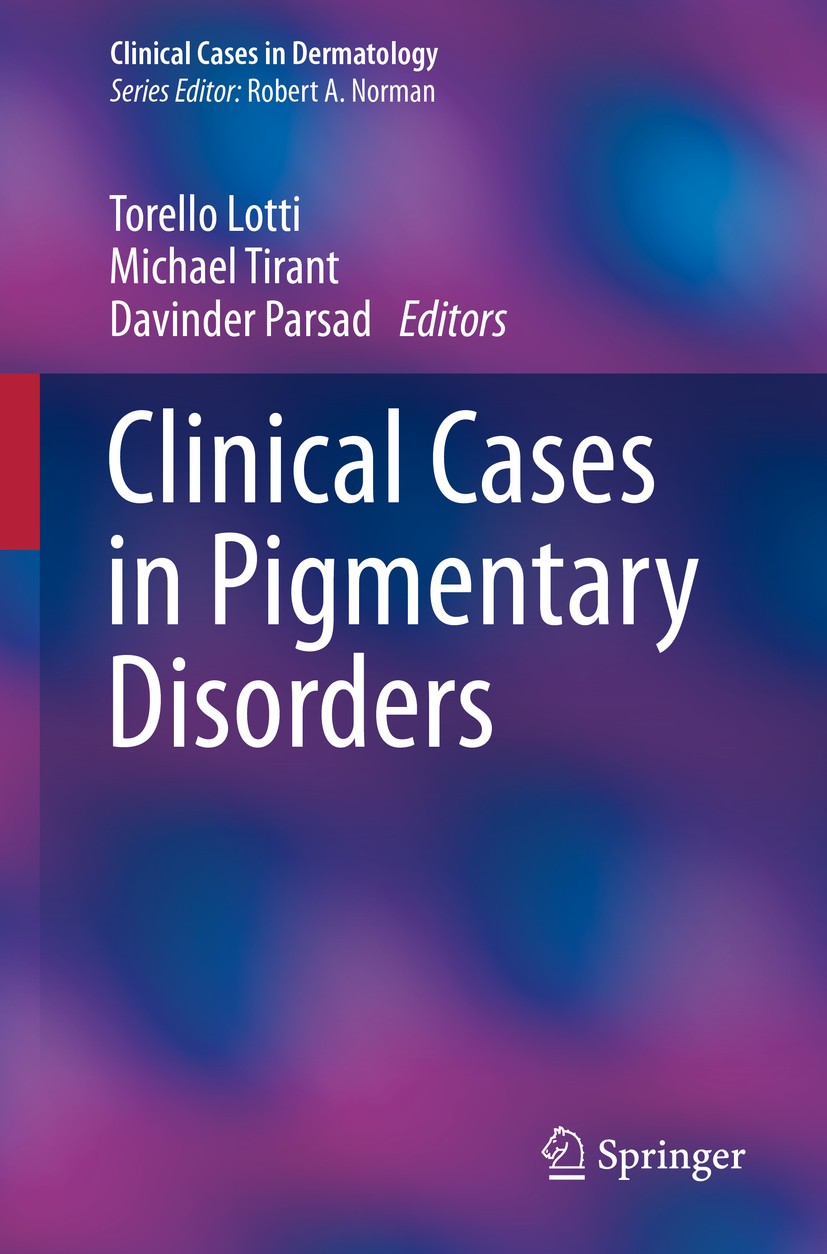 Titlebook: Clinical Cases in Pigmentary Disorders; Torello Lotti,Michael Tirant,Davinder Parsad Book 2020 Springer Nature Switzerland AG 2020 Acquire Titlebook: Clinical Cases in Pigmentary Disorders; Torello Lotti,Michael Tirant,Davinder Parsad Book 2020 Springer Nature Switzerland AG 2020 Acquire